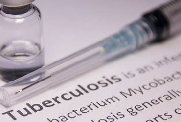 Screening for both active and dormant TB infection key to improve detection: Study